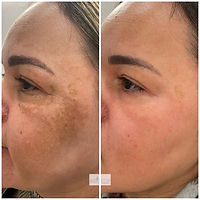 ✨ Sérum Vitamine C AESTHTANY – Éclat, Uniformité & Peau Visiblement Plus Jeune